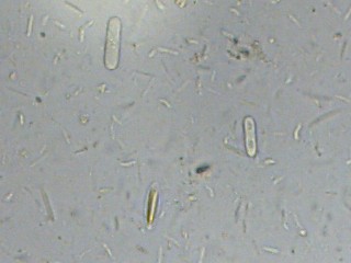 Sample picture make with MikrOkular from Bresser